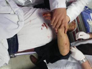 عاطف أبو سيف يتعرض لمحاولة قتل من قبل ميليشيا "حماس" تؤدي لعدة كسور في جسده