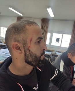 بيت لحم: الاحتلال يعتدي على الهيئة التدريسية في مدرسة تقوع بالضرب ويصيب العشرات بالاختناق